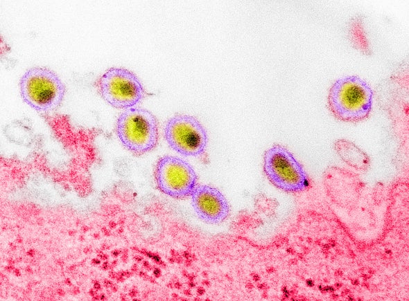 Discovery of New HIV Variant Sends Warning for COVID Pandemic