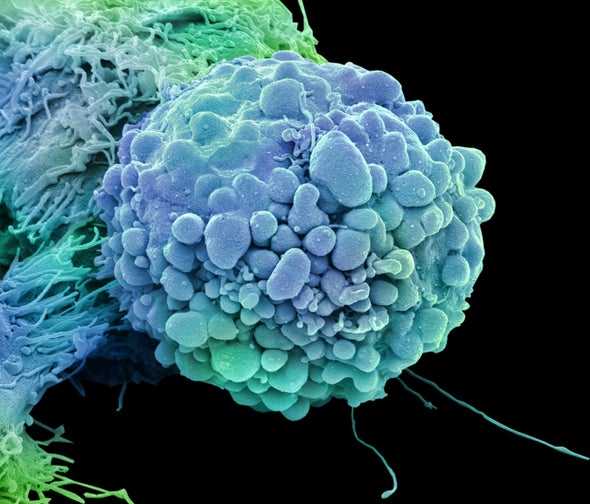 FDA Clears First Cancer Drug Based on Genetics of Disease, Not Tumor ...