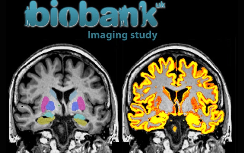 how much is a dog mri scan uk