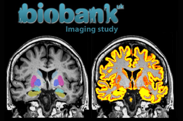 Massive U.K. Brain-Mapping Project Releases First Results
