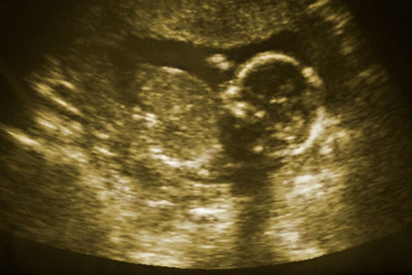 Ebola Strikes a Blow against Pregnant Women and Maternal Care