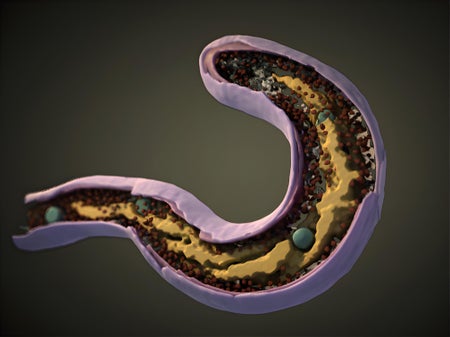 3-D structure of Bdellovibrio bacteriovorus bacterium, including membrane (purple), nucleoid (yellow), ribosomes (dark red) and dense granules (green).