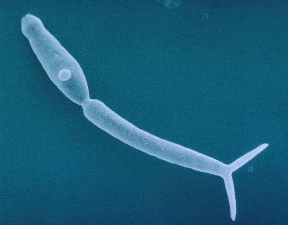 Creepy Swimmer's Itch Parasite in Northern Lakes Can Scratch Summer Fun