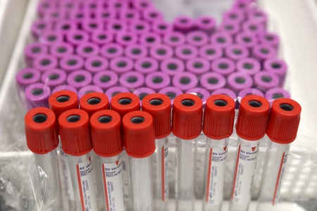 Empty blood vials with red and purple tops sit on a table