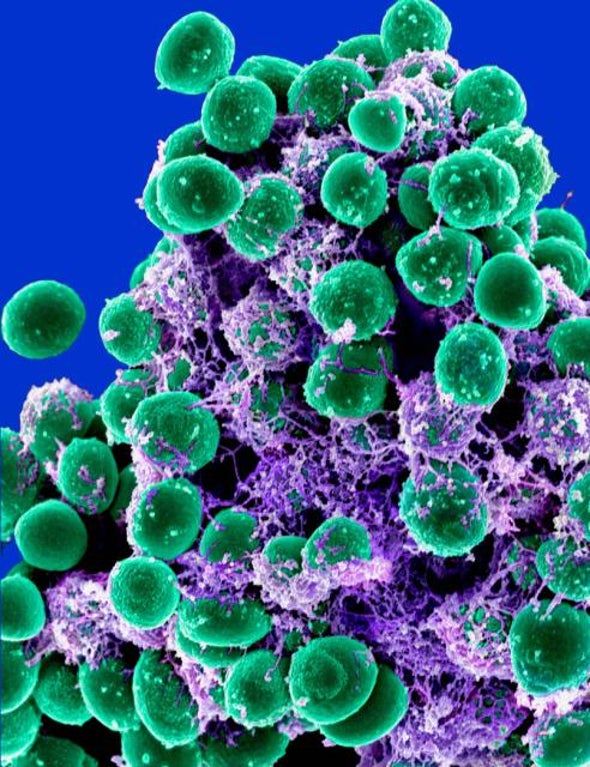 “Smuggler” Protein Finding Could Be Used to Disrupt Bacterial Cell Walls