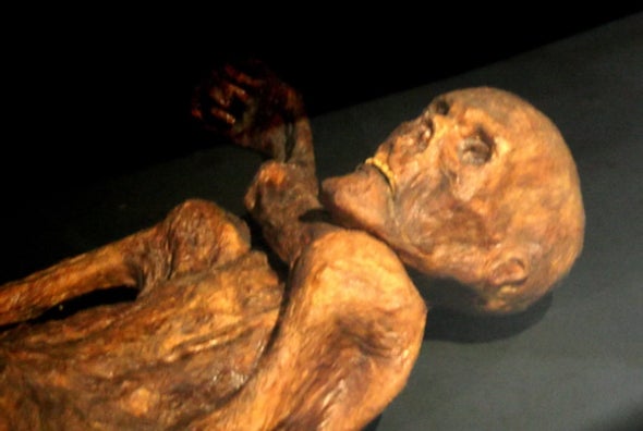 Iceman Ötzi Died with a Bellyache