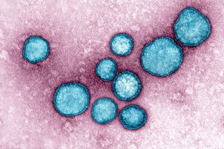 RSV Respiratory Syncytial Virus. Image produced using high-dynamic-range imaging (HDRI) from an image taken with transmission electron microscopy