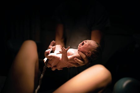 A newborn baby shown in hands, having just been delivered.