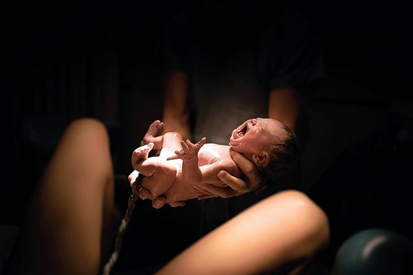 A newborn baby, just delivered, is seen in the hand.