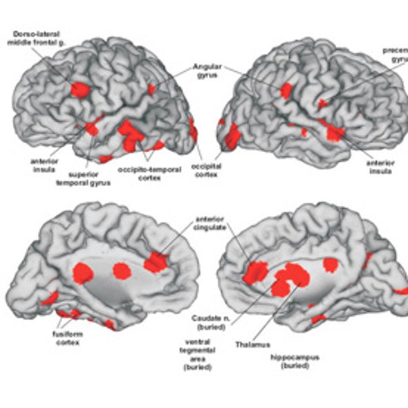 Passionate Love in the Brain, as Revealed by MRI Scans [Web Exclusive ...