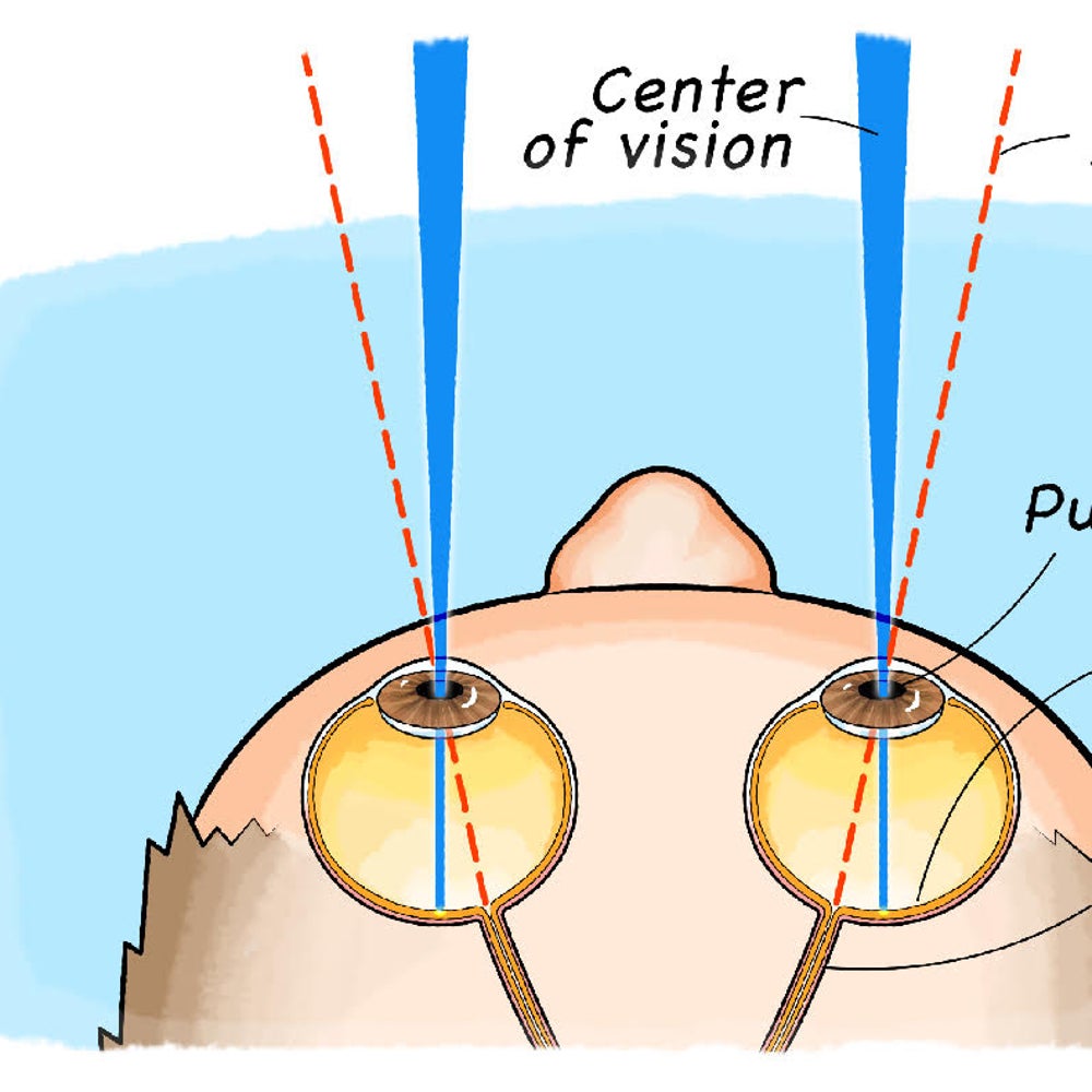 Find Your Blind Spot! | Scientific American