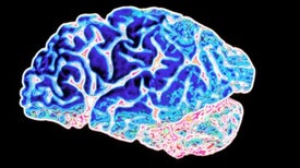 Is "Friendly Fire" in the Brain Provoking Alzheimer's Disease?