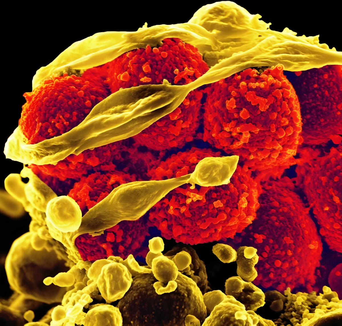 Staphylococcus aureus photo.