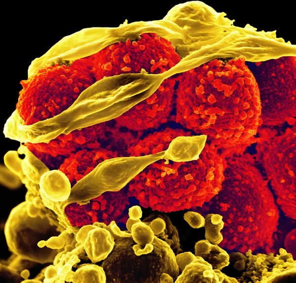 Micrograph of Staphylococcus aureus.