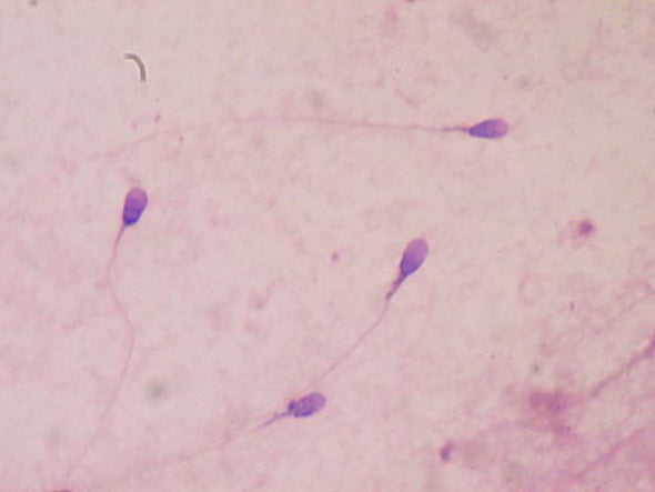 DDT Linked to Abnormal Sperm