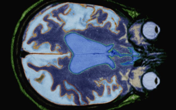 Traces of Genetic Trauma Can Be Tweaked
