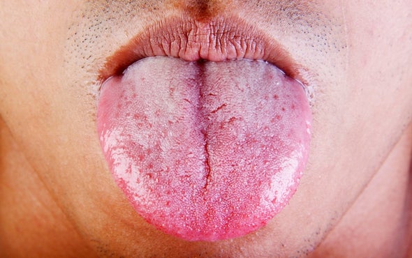 Mouth Sets Healing Standard