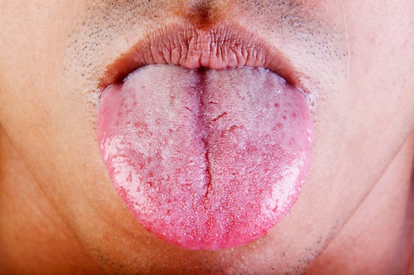 Mouth Sets Healing Standard