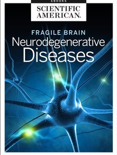 Fragile Brain: Neurodegenerative Diseases