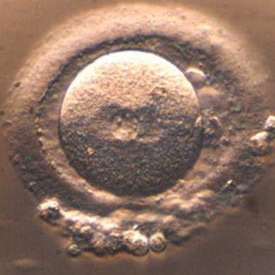 Mississippi to Vote on "Personhood" of Fertilized Eggs