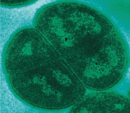 Deinococcus radiodurans microbe close-up in green.