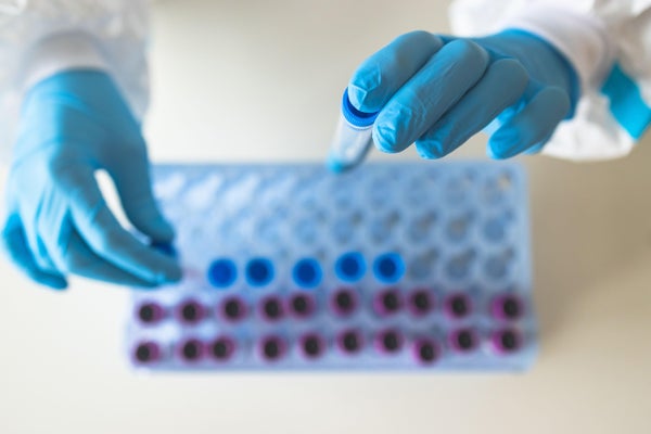 PCR antigen testing examination by nurse with blue gloves.