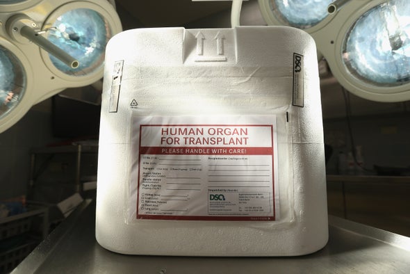 How Scientists Revived Dead Pigs' Organs, and What the Feat Means for Transplants