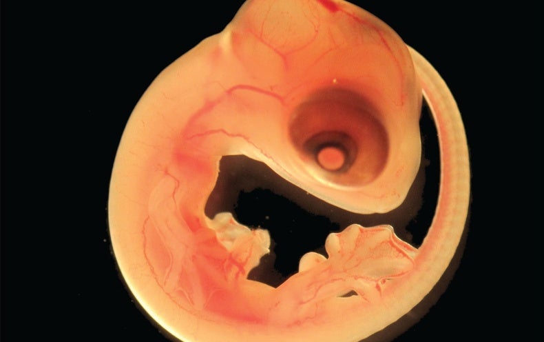 Parasites Thrive in Lizard Embryos’ Brain