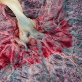 Fetal Armor: How the Placenta Shapes Brain Development