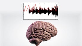 How Does Your Brain Follow the Music?