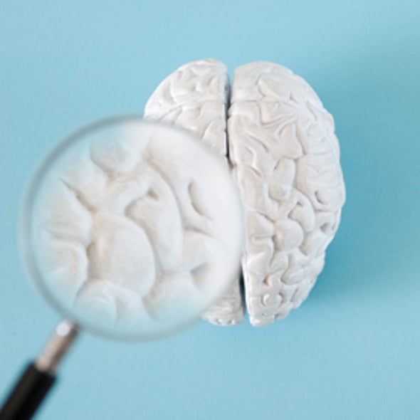 To Tell the Truth: Brain Scans Are Not Ready for the Courtroom