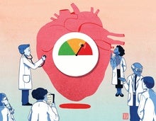 Too Much 'Good' Cholesterol Can Harm the Heart