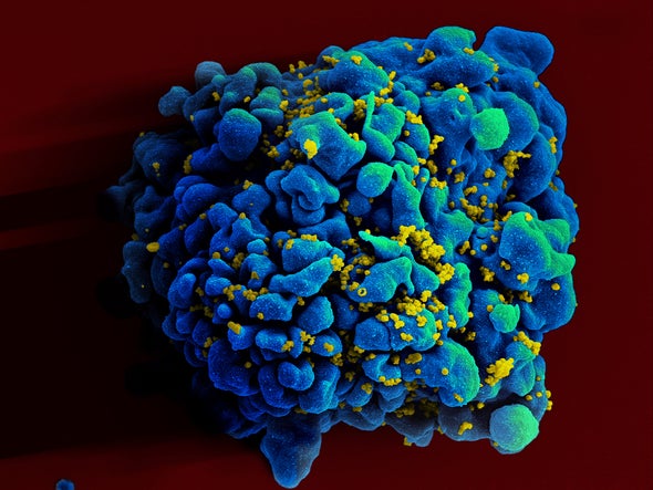 CRISPR Identifies Potential Gene Targets to Hobble HIV Infection