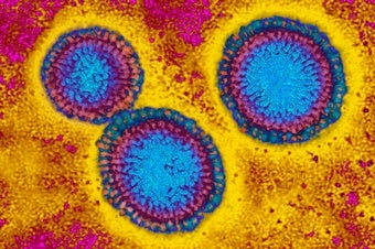 How Does the Flu Actually Kill People?