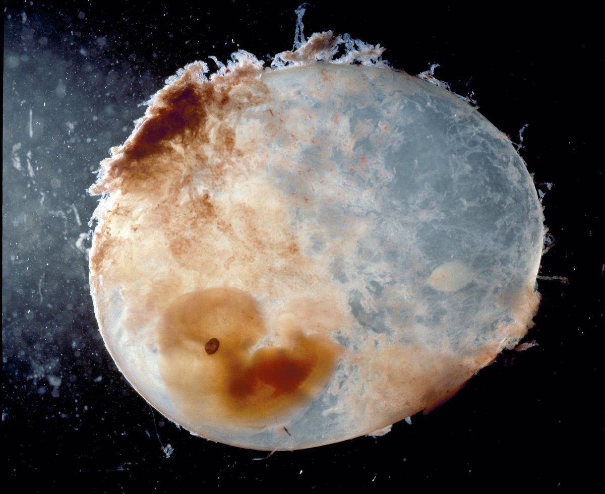 Scientists Seek Better Guidelines for Editing Genes in Human Embryos ...