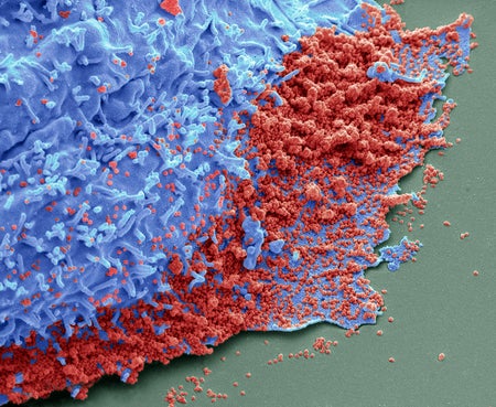 Microscopic view of coronavirus