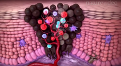 Future of Medicine: How Doctors Boost the Immune System to Fight Cancer [Video]