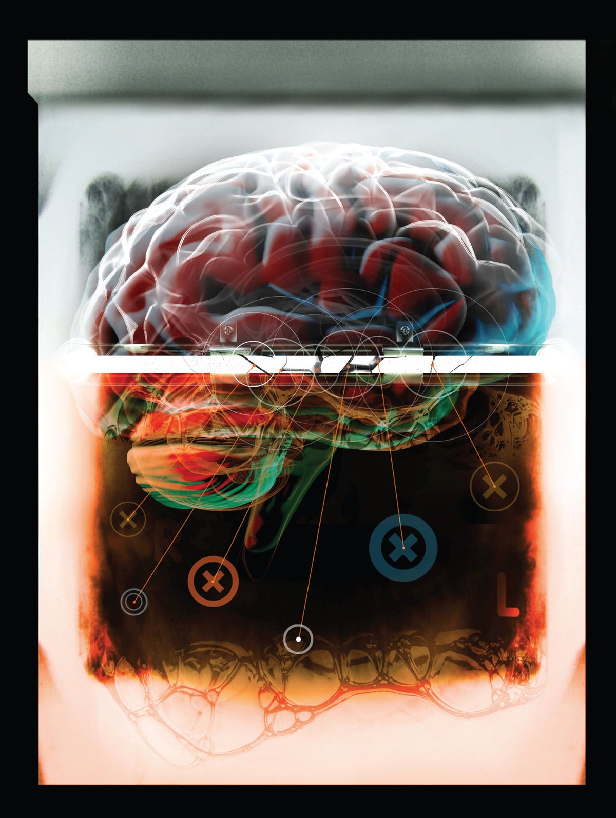 Cognitive impairments correlate with increased central nervous