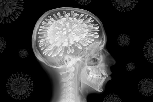 Skull x-ray with coronavirus, illustration.