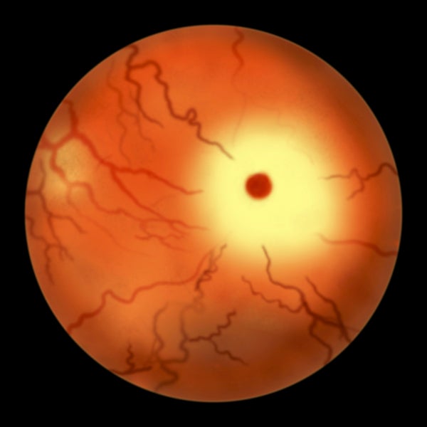 Illustration of human eye retina