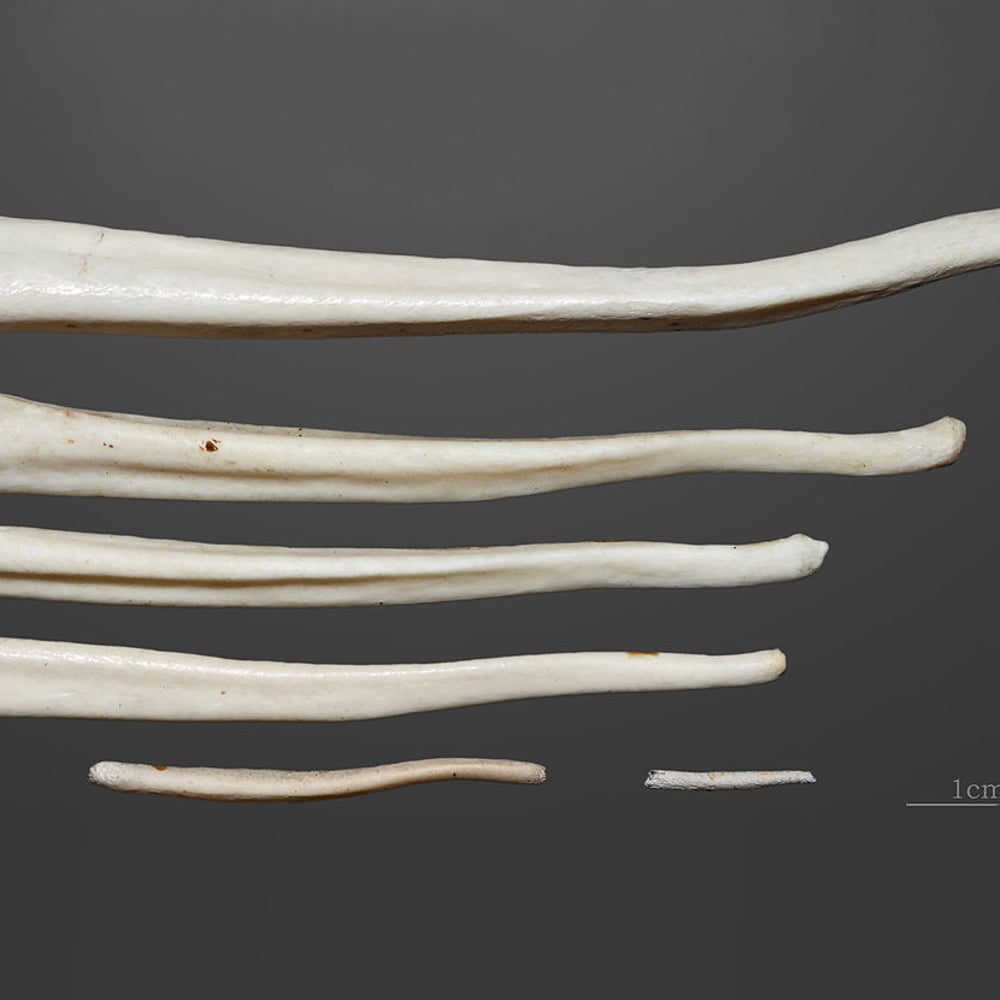 Why Humans Have No Penis Bone | Scientific American