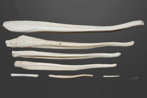 Why Humans Have No Penis Bone