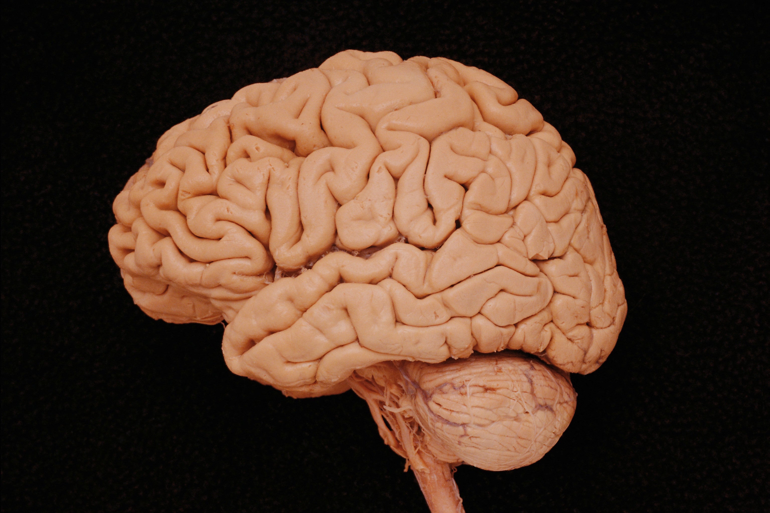 Человеческий мозг. Головной мозг.