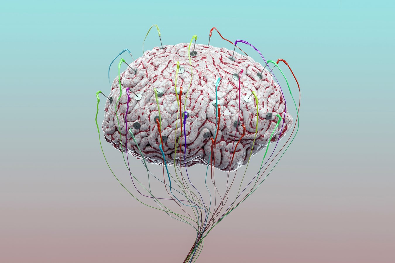 Brain Stimulation Partly Awakens Patient after 15 Years in Vegetative ...