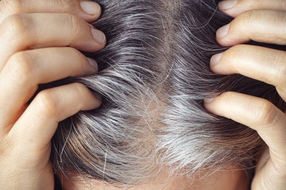 Gray Hair Can Return to Its Original Color--and Stress Is Involved, of Course