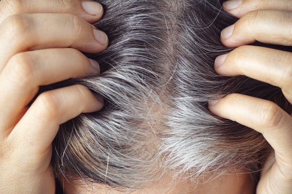A person shows their grey hair roots.