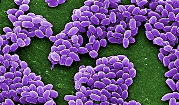 Government Report Calls for Better Oversight of Labs Handling Dangerous Pathogens