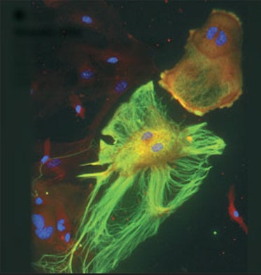 Brain Cells Can Look Ghostly