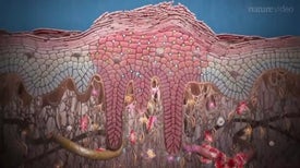 Scientists Find New Drug Targets for Psoriasis