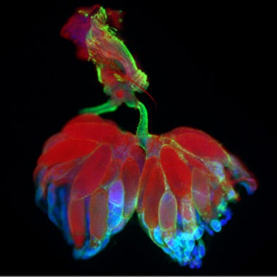 Stunning Images Under the Microscope Capture the Lives of the Tiniest Creatures [Slide Show]